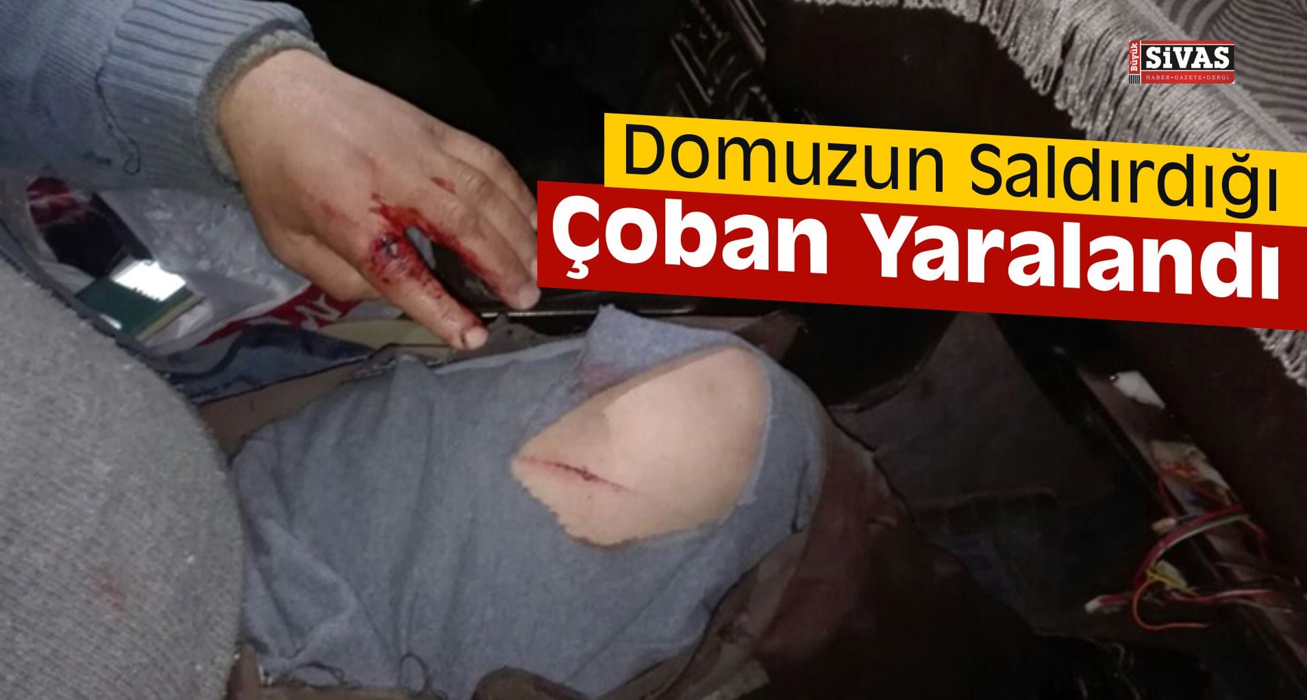 Sivas’ta Domuzun Saldırdığı Çoban Yaralandı