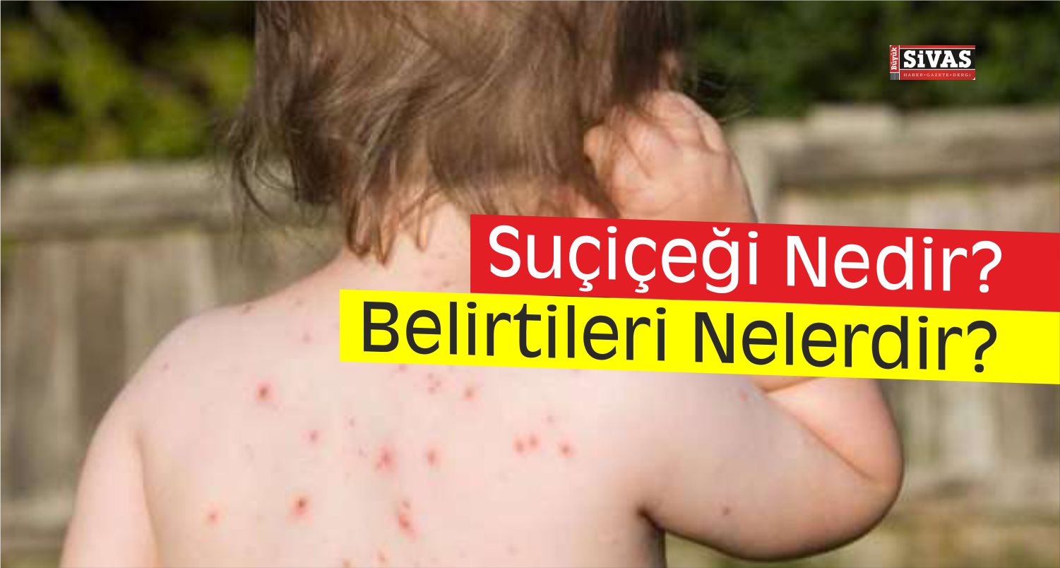 suçiçeği