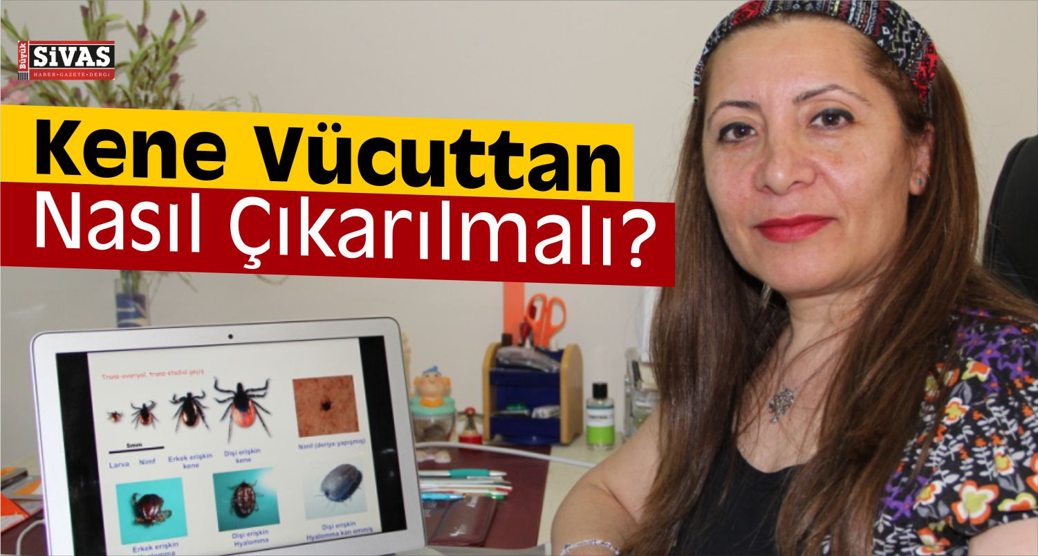 Kene Vücuttan nasıl çıkarılır