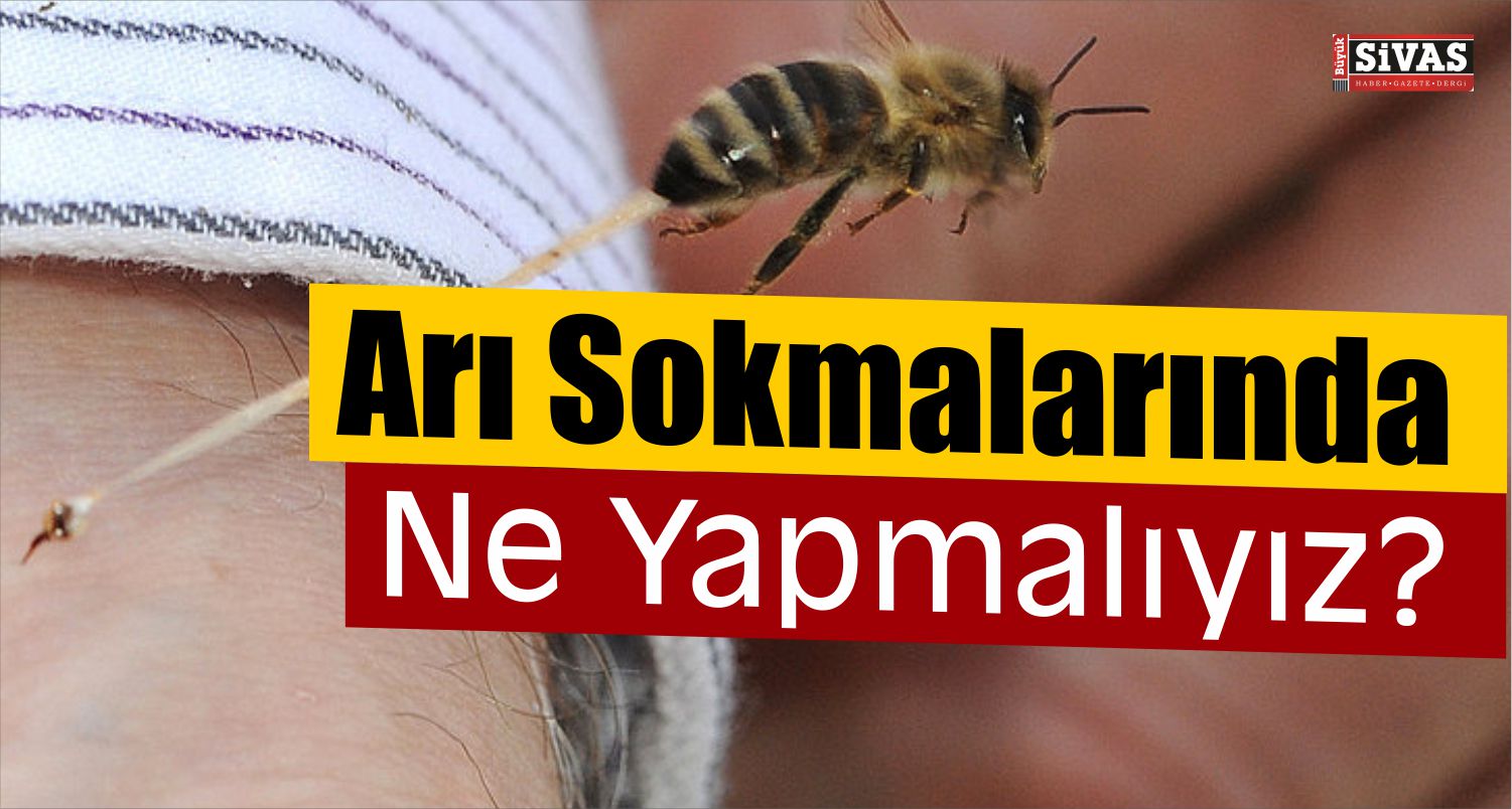 Arı Sokmalarında ne yapılmalı
