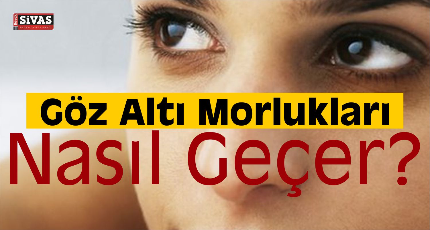 Göz Altı Morlukları Nasıl Giderilir
