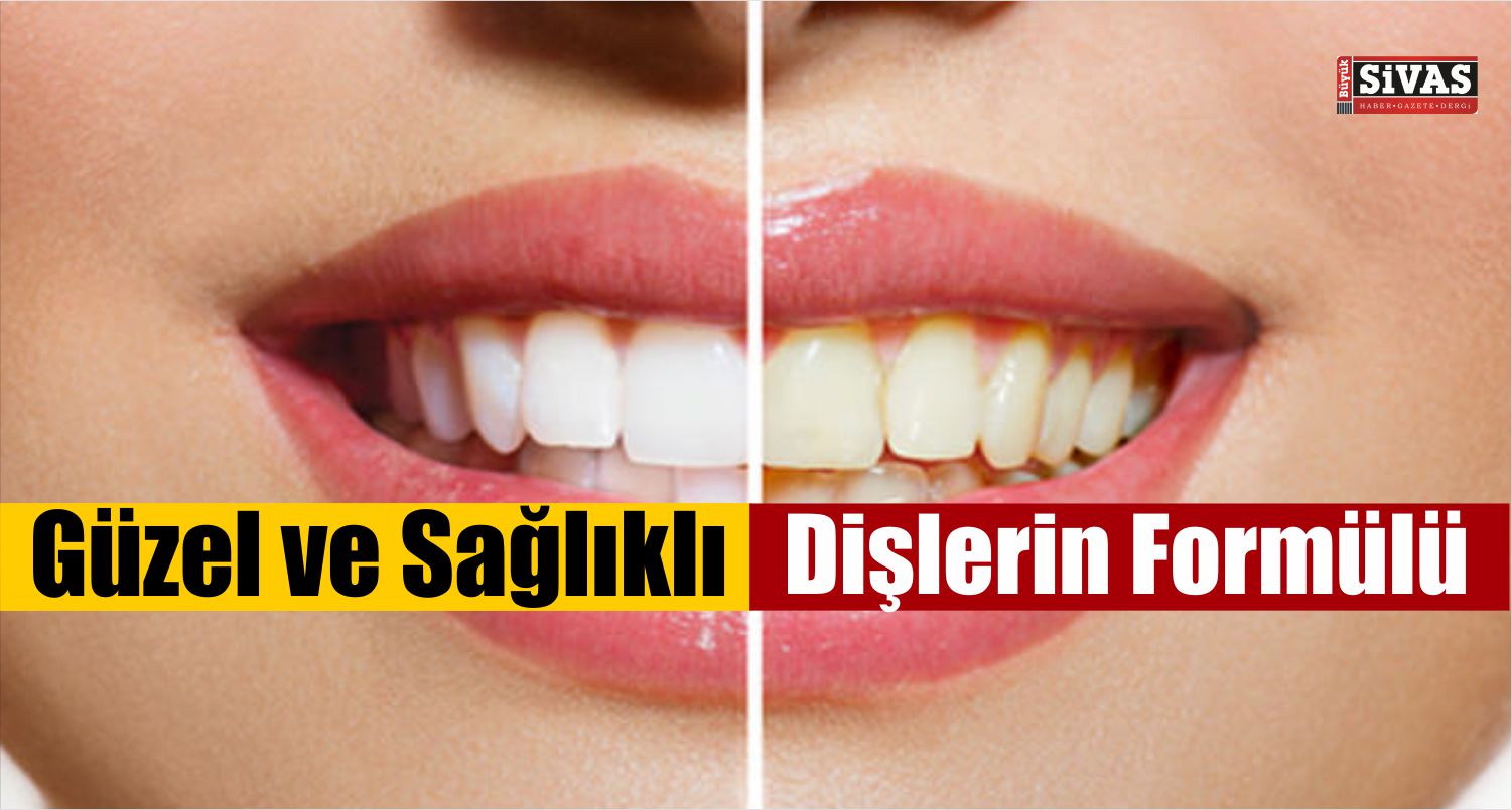 Güzel ve Sağlıklı Dişlerin Formülü Nedir?