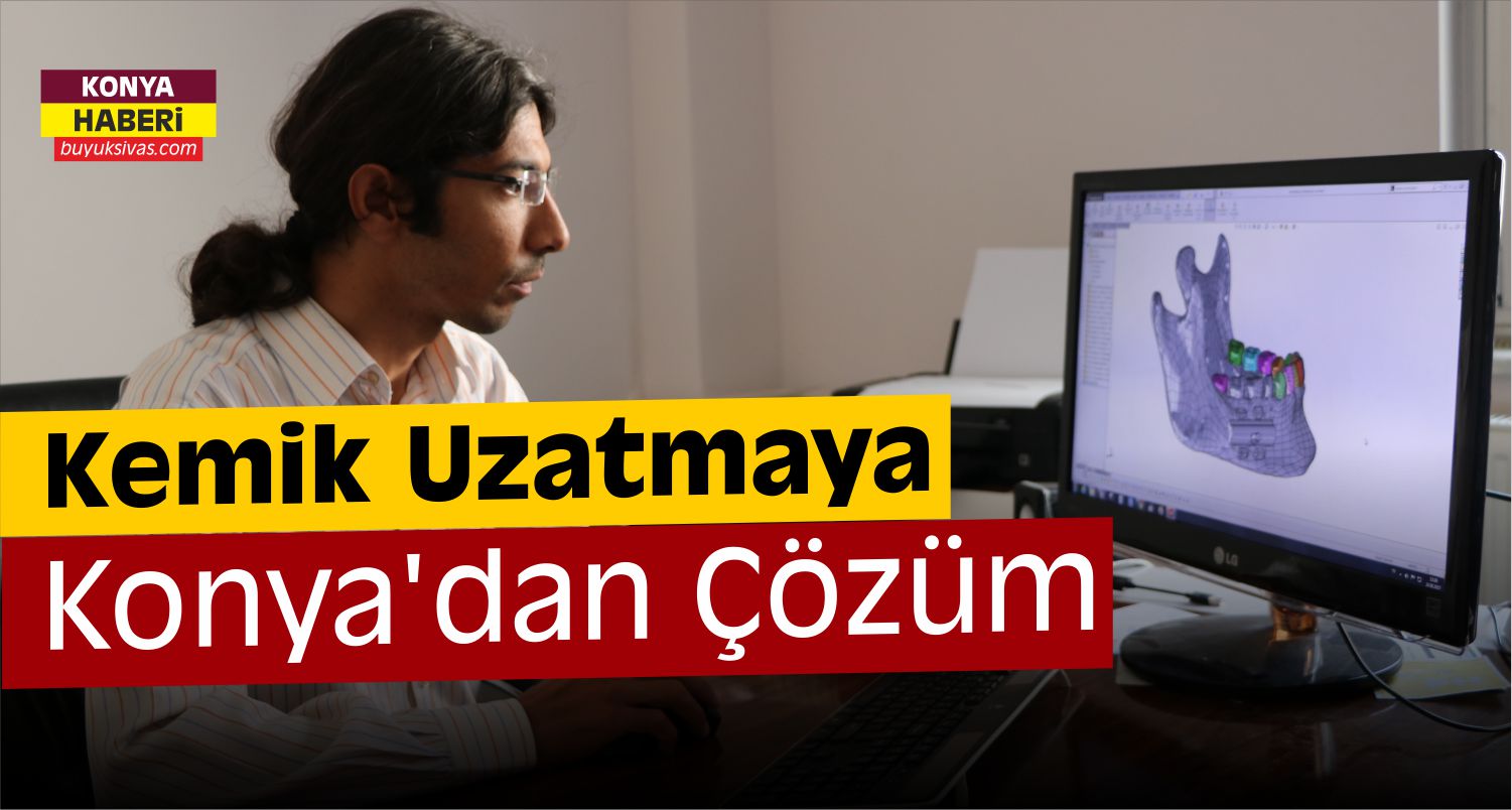 Konya’da Kemik Uzatmaya Yerli Çözüm