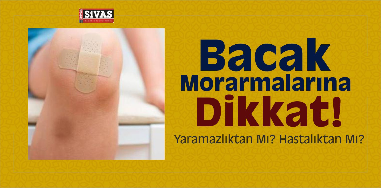 bacak neden morarır