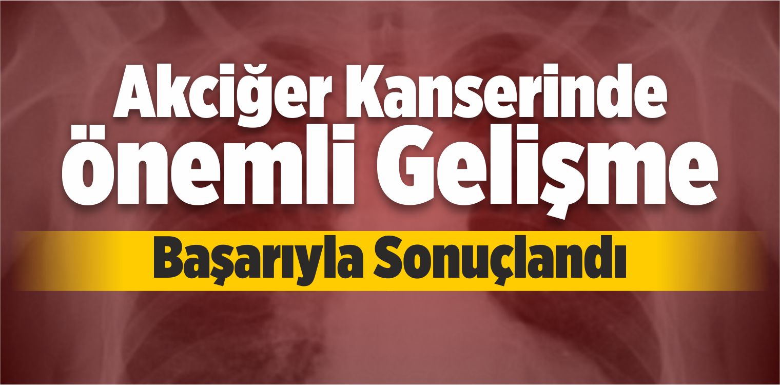 Akciğer Kanserinde Önemli Gelişme