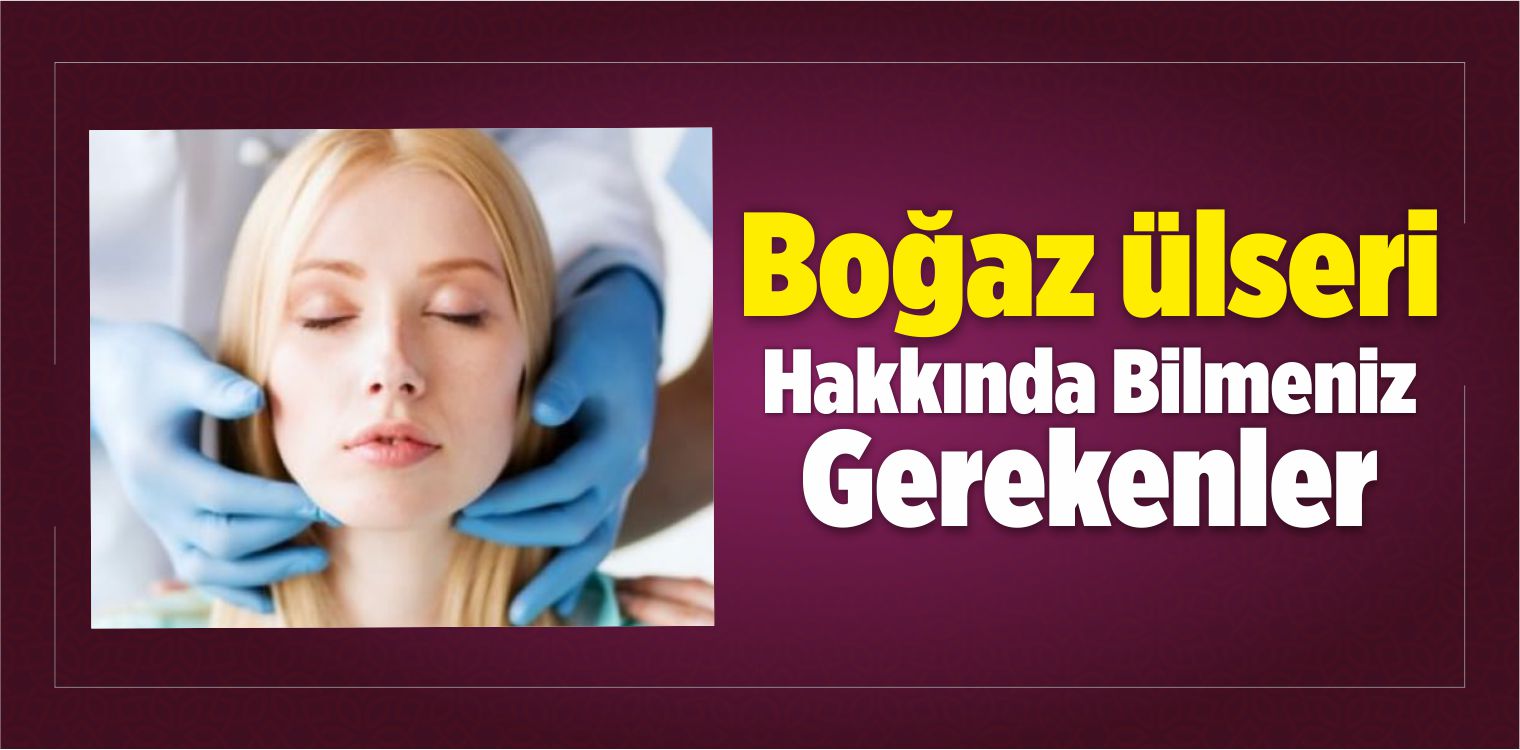 Boğaz ülseri