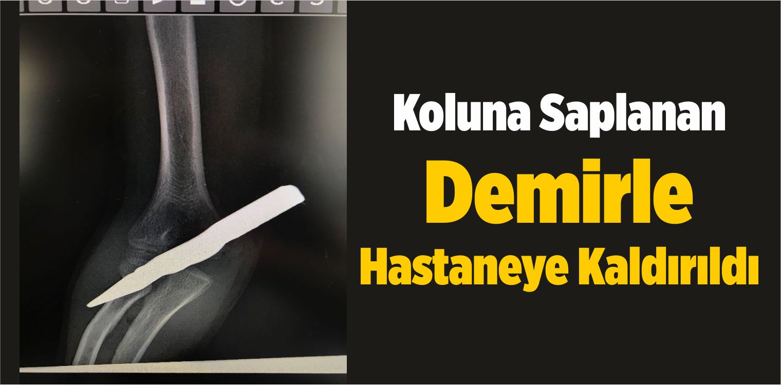Koluna Saplanan Demirle Hastaneye Kaldırıldı