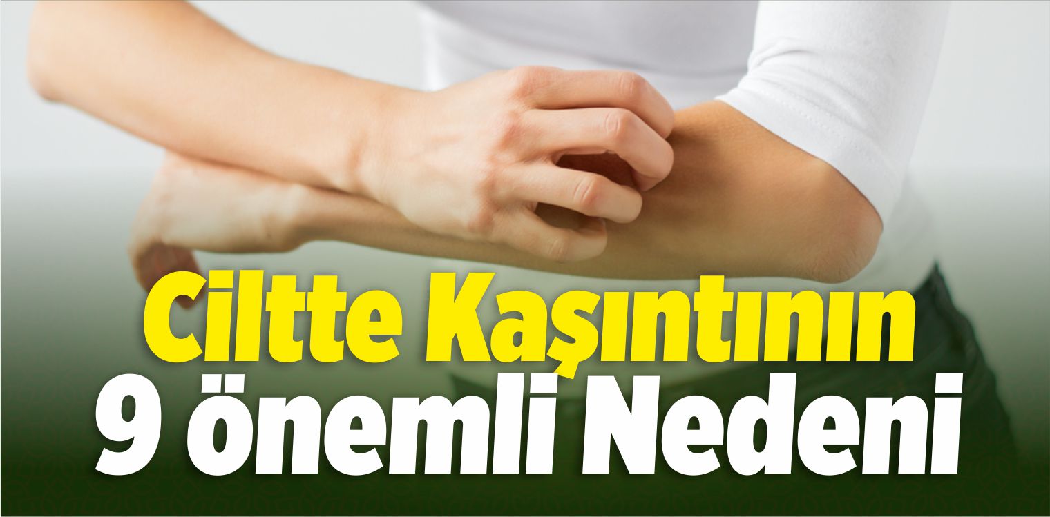 Ciltte Kaşıntının 9 Önemli Nedeni
