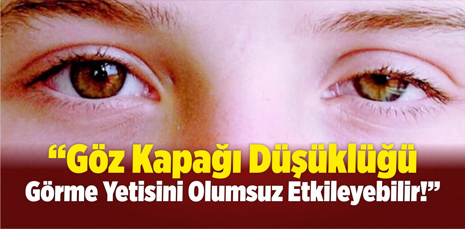Göz Kapağı Düşüklüğü