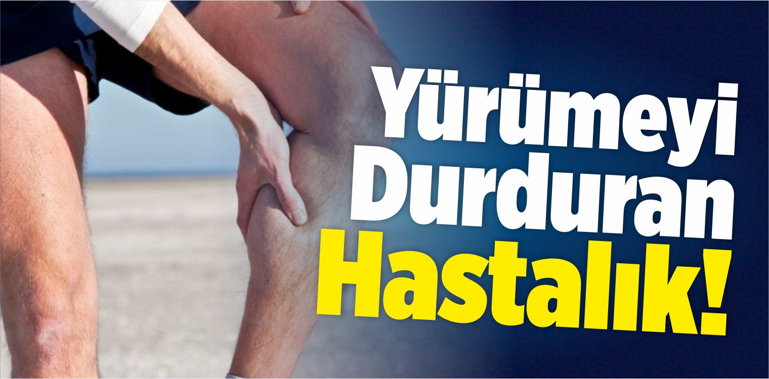 Yürümeyi