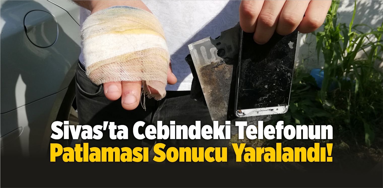 Sivas’ta Cebindeki Telefonun Patlaması Sonucu Yaralandı!