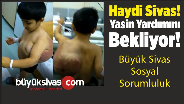 Haydi Büyük Sivas! Yasin Kozu Yardımını Bekliyor! Çözelim Bu işi…