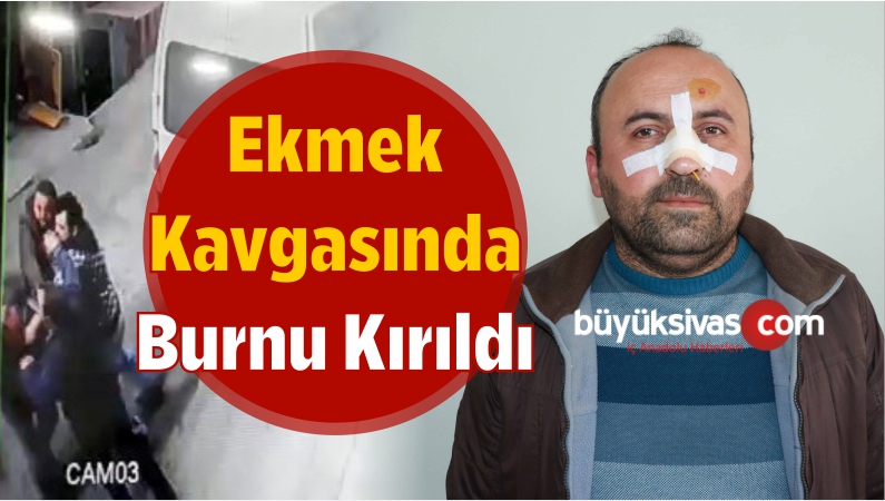 Burnu Kırıldı