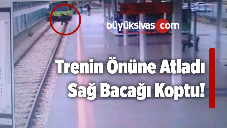 Trenin Önüne Atladı Sağ Bacağı Koptu!