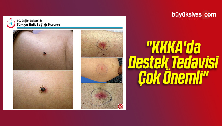 “KKKA’da Destek Tedavisi Çok Önemli”