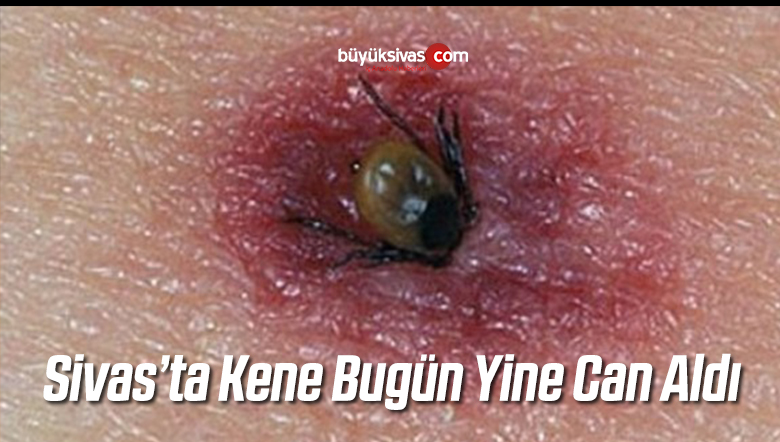 Sivas’ta Kene Yine Can Aldı! Hastanede Hayatını Kaybetti!