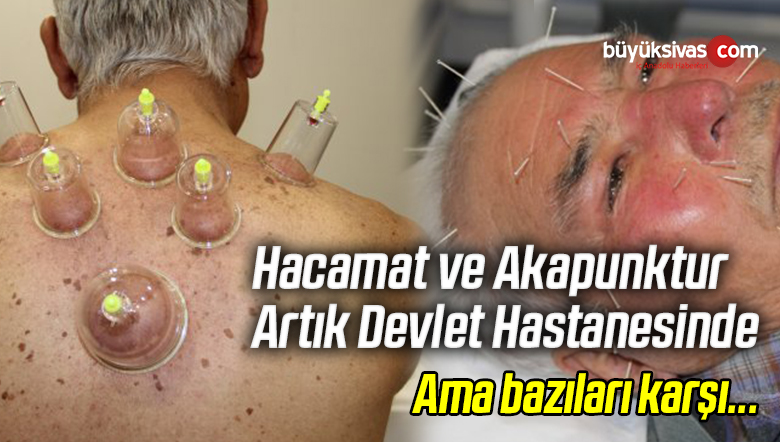 Hacamat ve Akapunktur Artık Devlet Hastanesinde! Karşı Olanlar Olsa da
