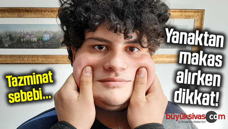 Şşş Şakacılar! Yanaktan ‘makas almak’ tazminat sebebi