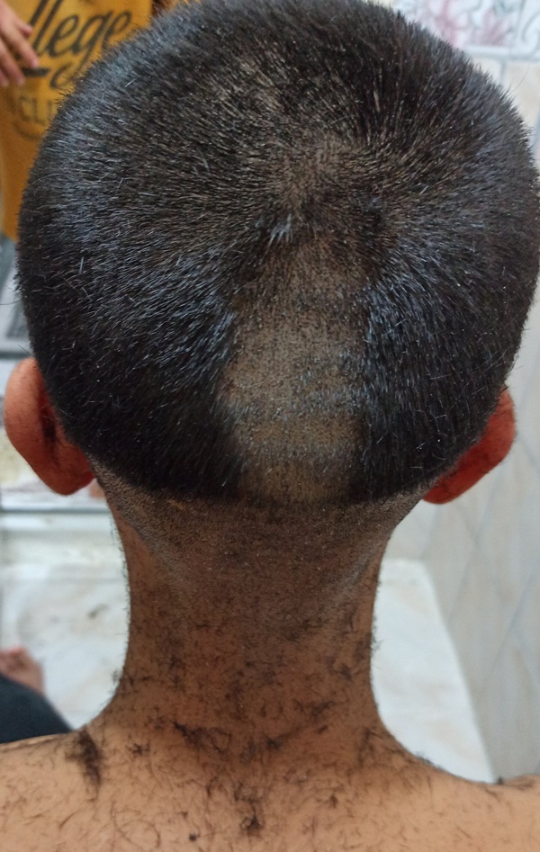 başı dertte