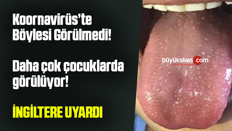 ingiltere