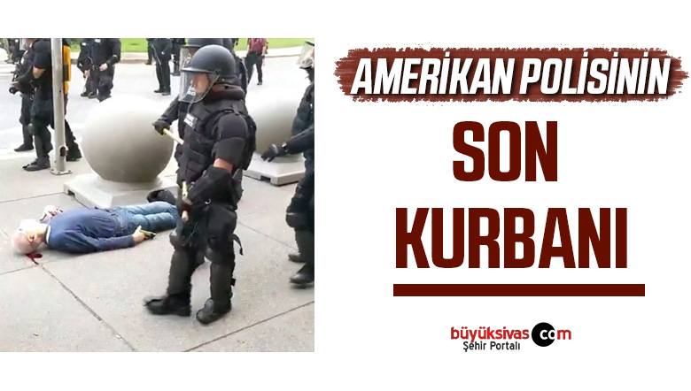 ABD polisi, yaşlı adamın kafasını yardı