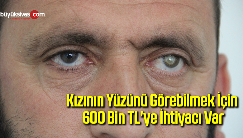 kızının yüzünü görebilmek için 600 bin TL’ye ihtiyacı var