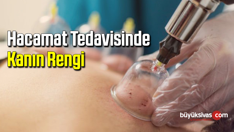 HACAMAT TEDAVİSİNDE KANIN RENGİ ÇOK ÖNEMLİ !