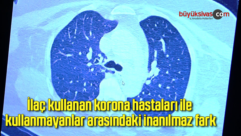 İlaç kullanan korona hastaları ile kullanmayanlar arasındaki inanılmaz fark