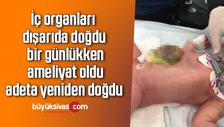 İç organları dışarıda doğdu, bir günlükken ameliyat oldu, adeta yeniden doğdu