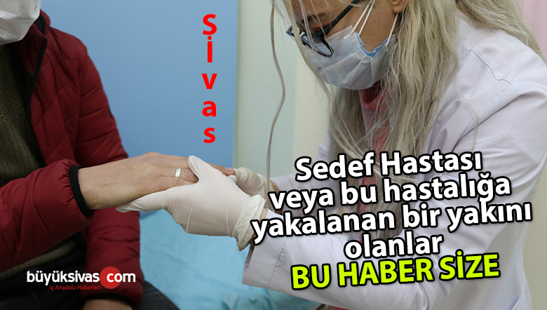 Sivas’ta güzel şeyler oluyor! Sedef hastalarına sevindiren haber