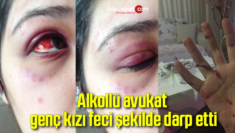 Alkollü avukat genç kızı feci şekilde darp etti