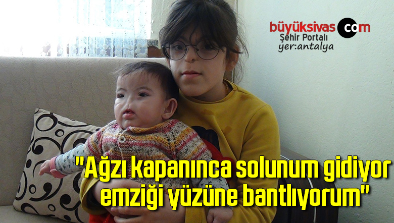 Burnu Olmadan Dünyaya Gelen Çocukları İçin Destek Bekliyor