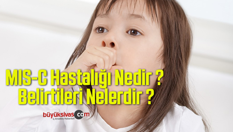 MIS-C Hastalığı Nedir ? Belirtileri Nelerdir ?