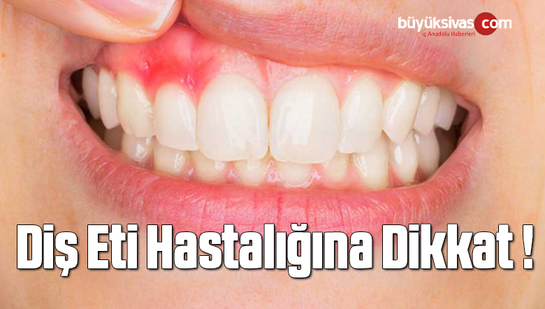 Diş Eti Hastalığına Dikkat !