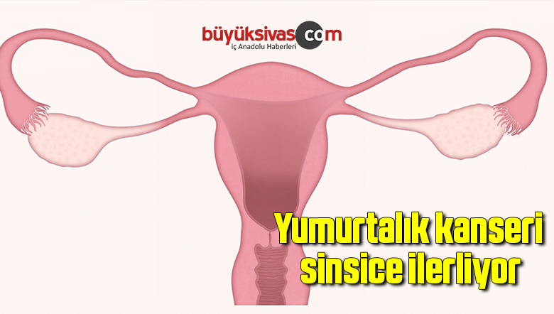 Yumurtalık kanseri sinsice ilerliyor