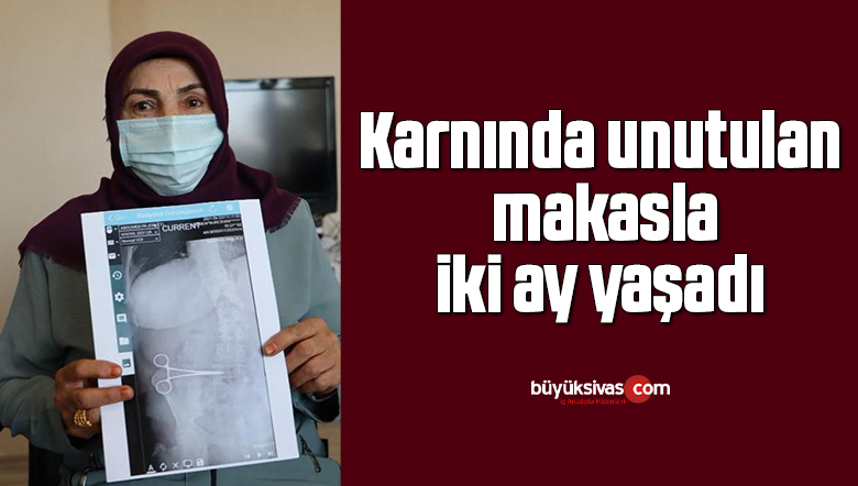 Karnında unutulan makasla iki ay yaşadı