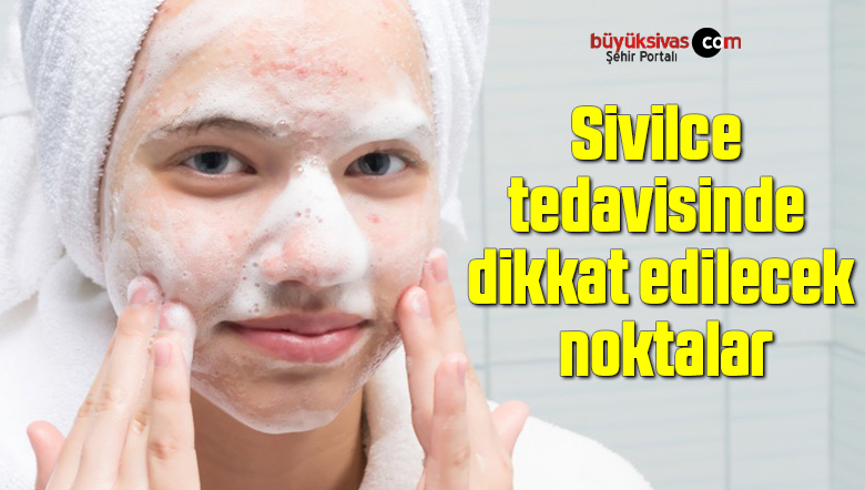 Sivilce tedavisinde dikkat edilecek noktalar