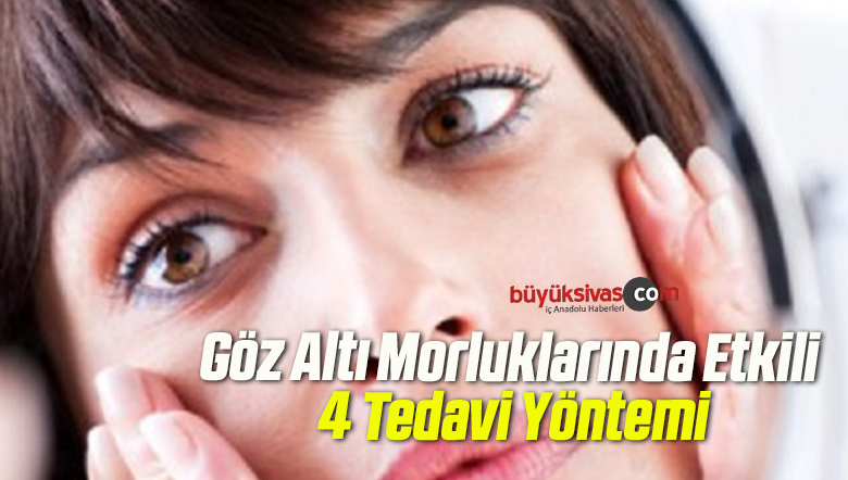 Göz Altı Morluklarında Etkili 4 Tedavi Yöntemi