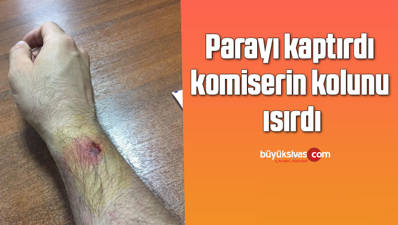 Kumar oynanan mekanı polis bastı ! paraları toplayan komiserin kolunu ısırıldı
