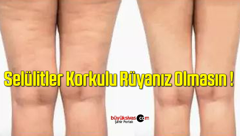 Yaz Ayları Yaklaşırken Selülitler Korkulu Rüyanız Olmasın !