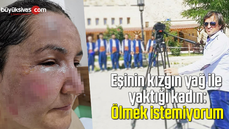 Eşinin kızgın yağ ile yaktığı kadın: Ölmek istemiyorum