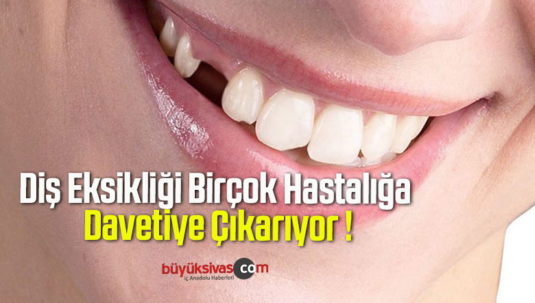 diş eksikliği
