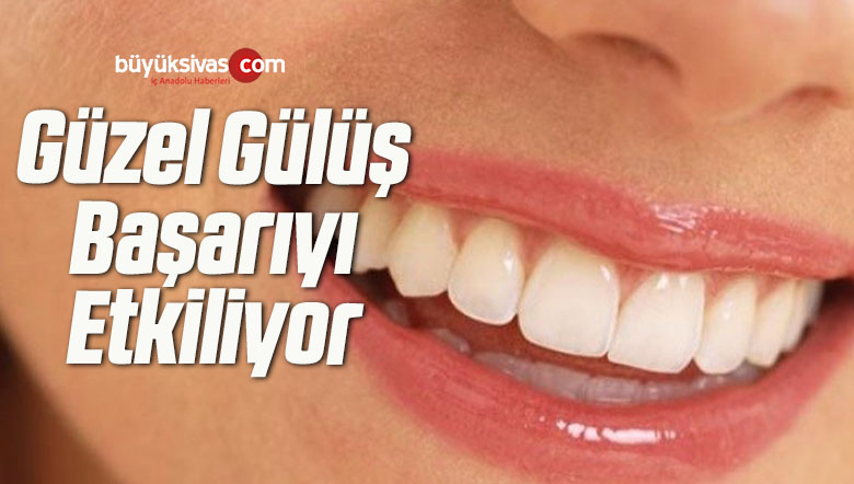 güzel gülüş