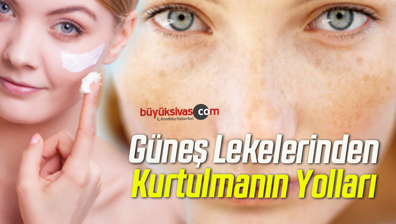 Güneş Lekelerinden Kurtulmanın Yolları