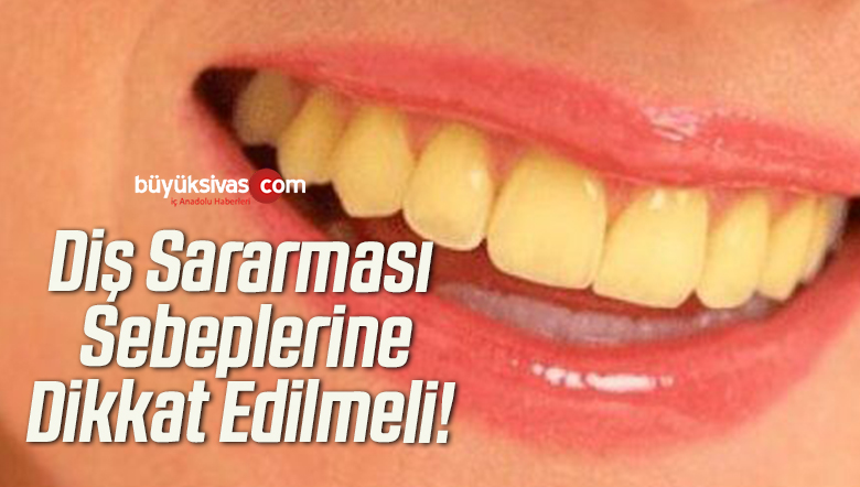 Diş Sararması