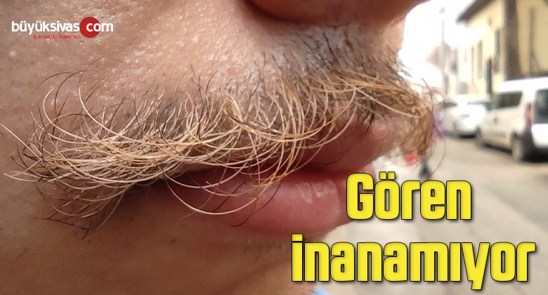 Gören inanamıyor, sadece bıyıkları sarı