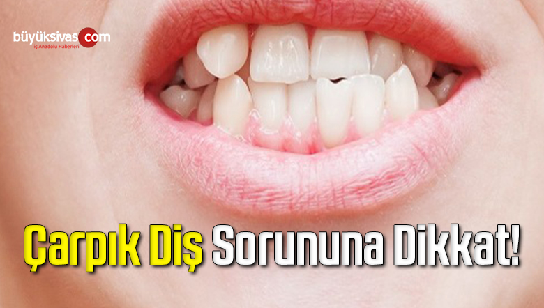 Çarpık Diş Sorununa Dikkat!