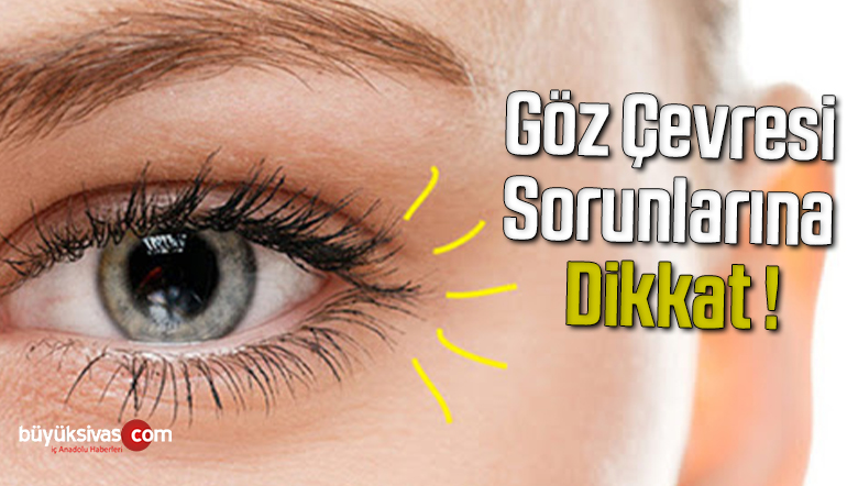 Göz Çevresi Sorunlarına Dikkat !