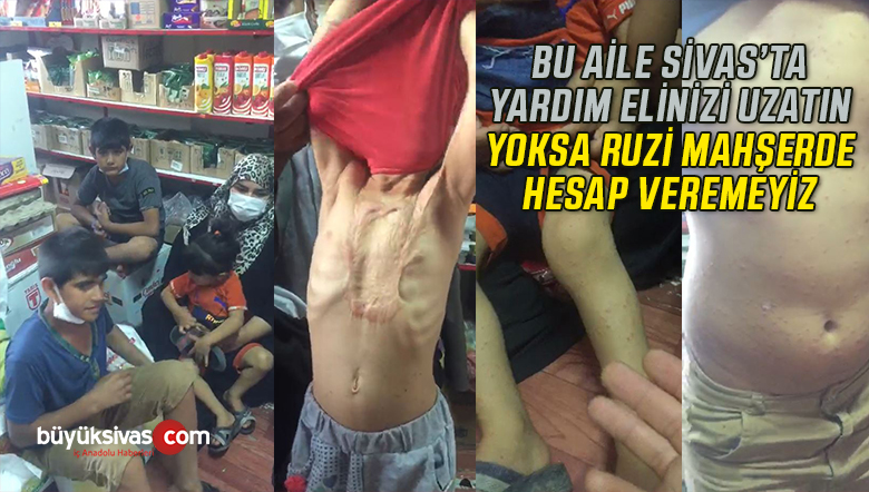 Sivas’ta yaşayan bu yavrucaklara yardım elinizi uzatın! Yoksa hesabı mahşerde ağır olur