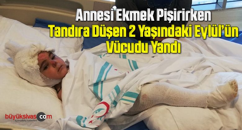 Tandıra düşen 2 yaşındaki çocuğun vücudu yandı